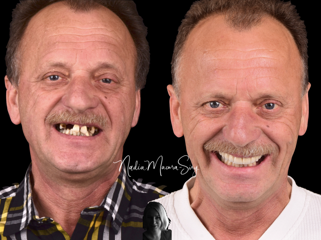 Metamorfoza uśmiechu - Dentysta Strzelin